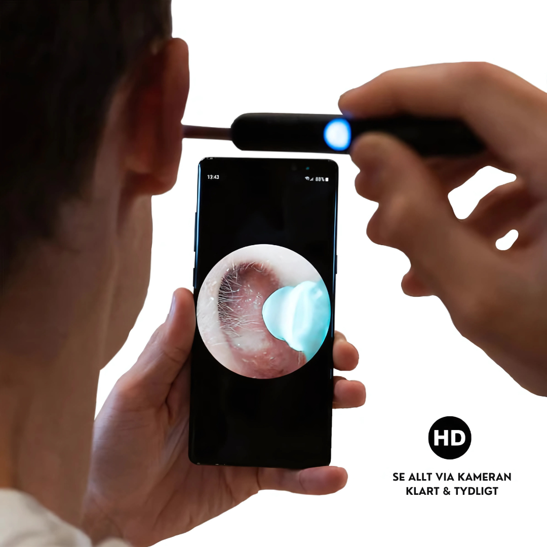 Smart medical cutting-edge technology - visual ear canal cleaning