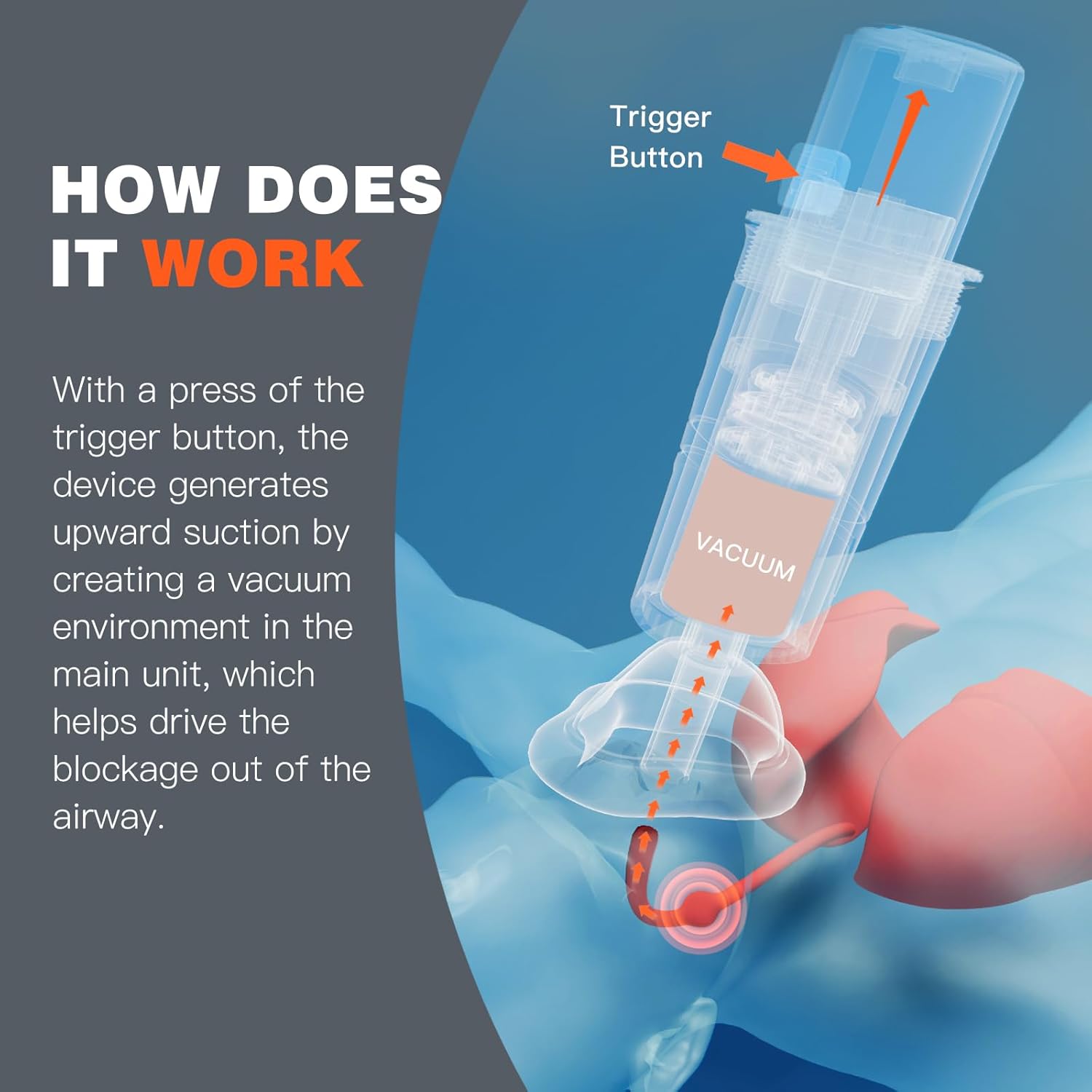 Heimlich emergency device